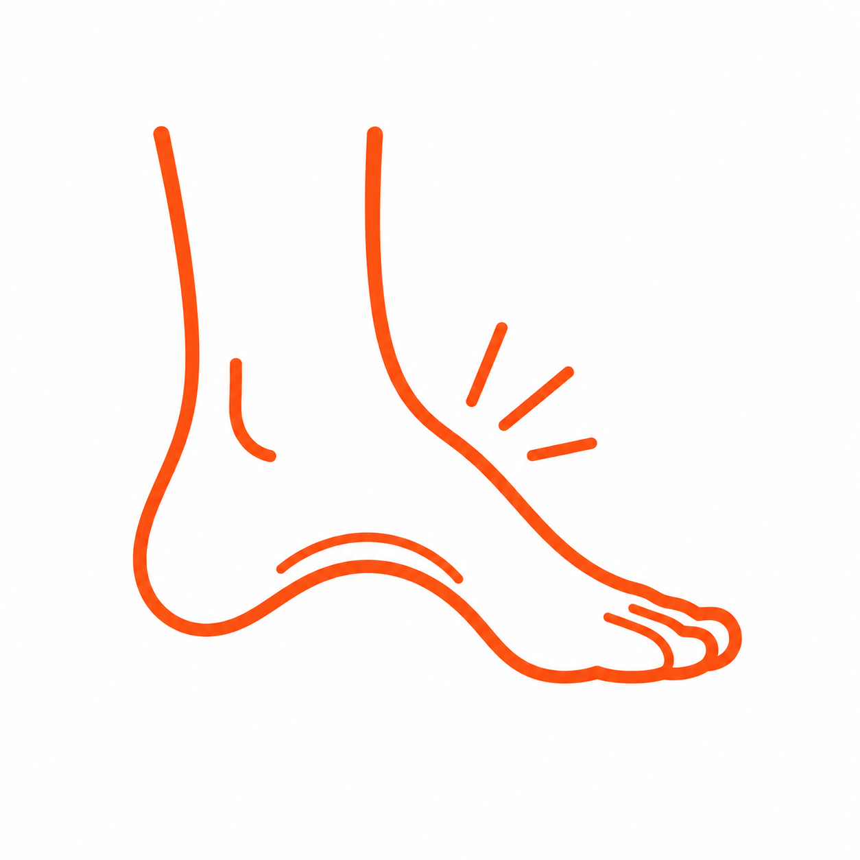 High Arches (Supination)
