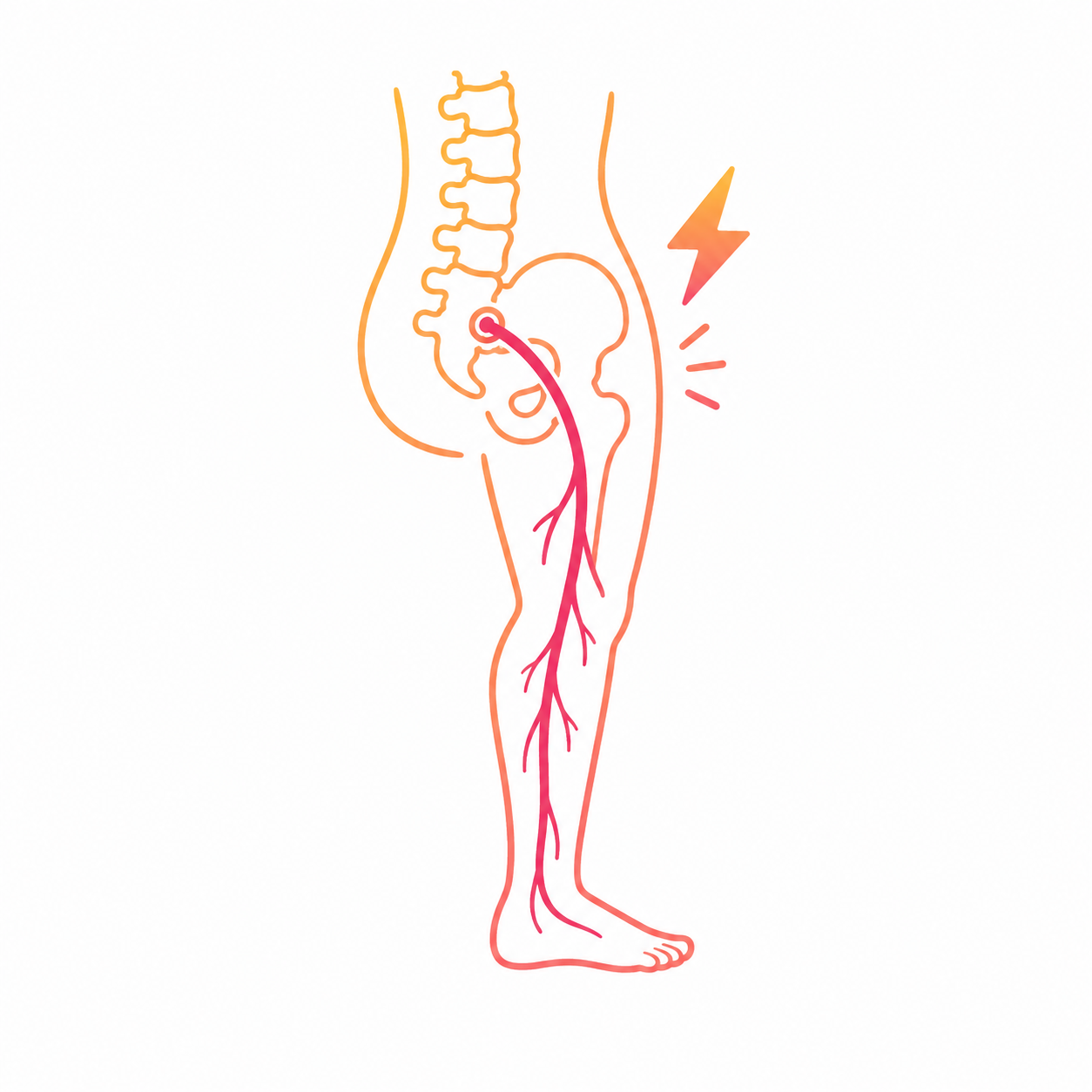 Chiropractic Care for Sciatica