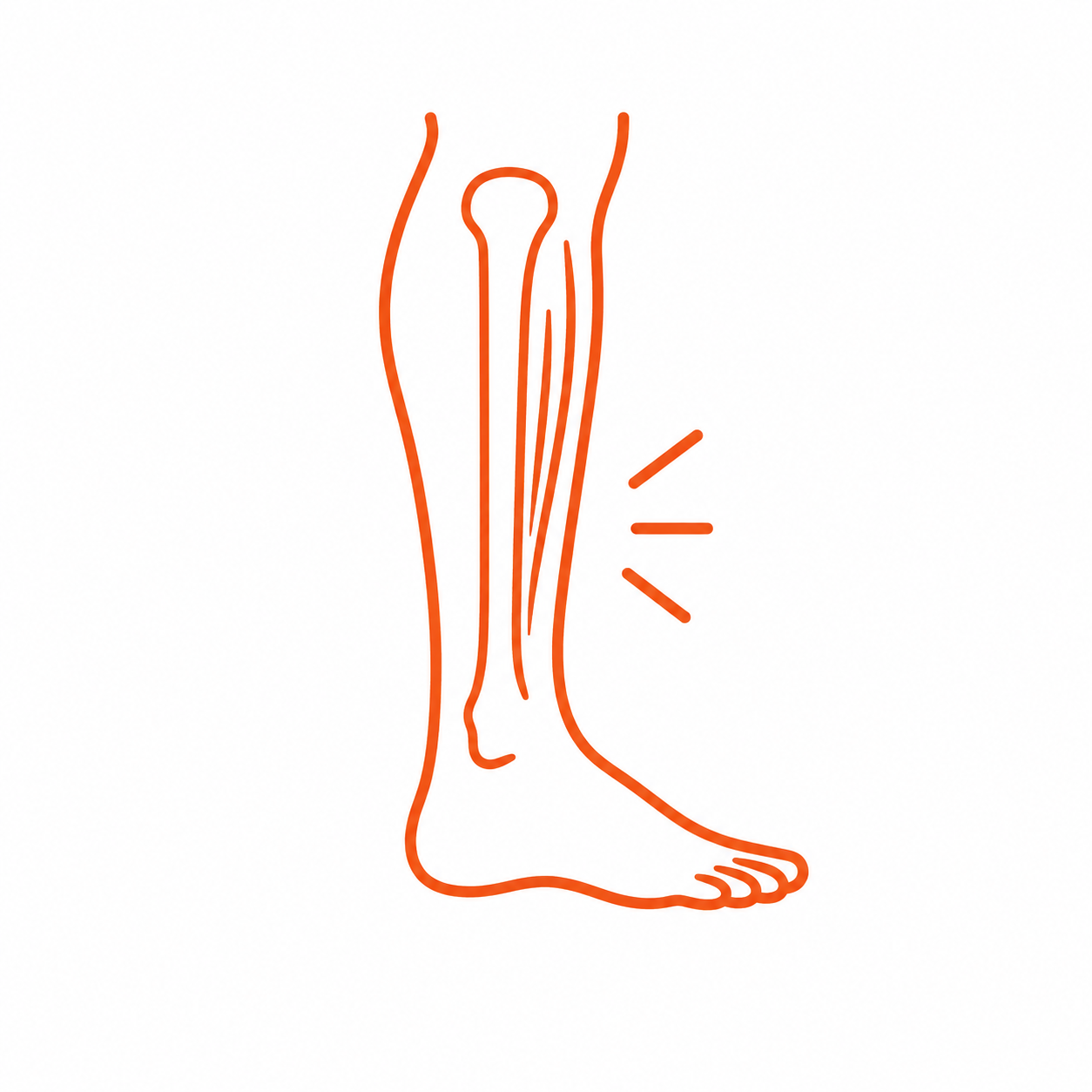 Shin Splints